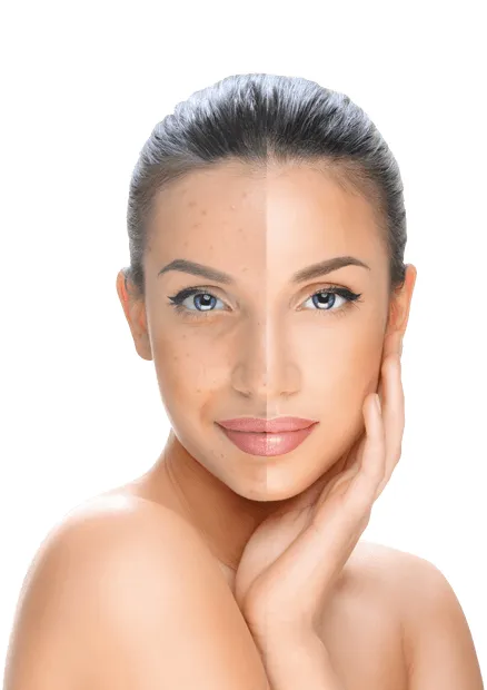 Serum wybielania niacynamid i pieg